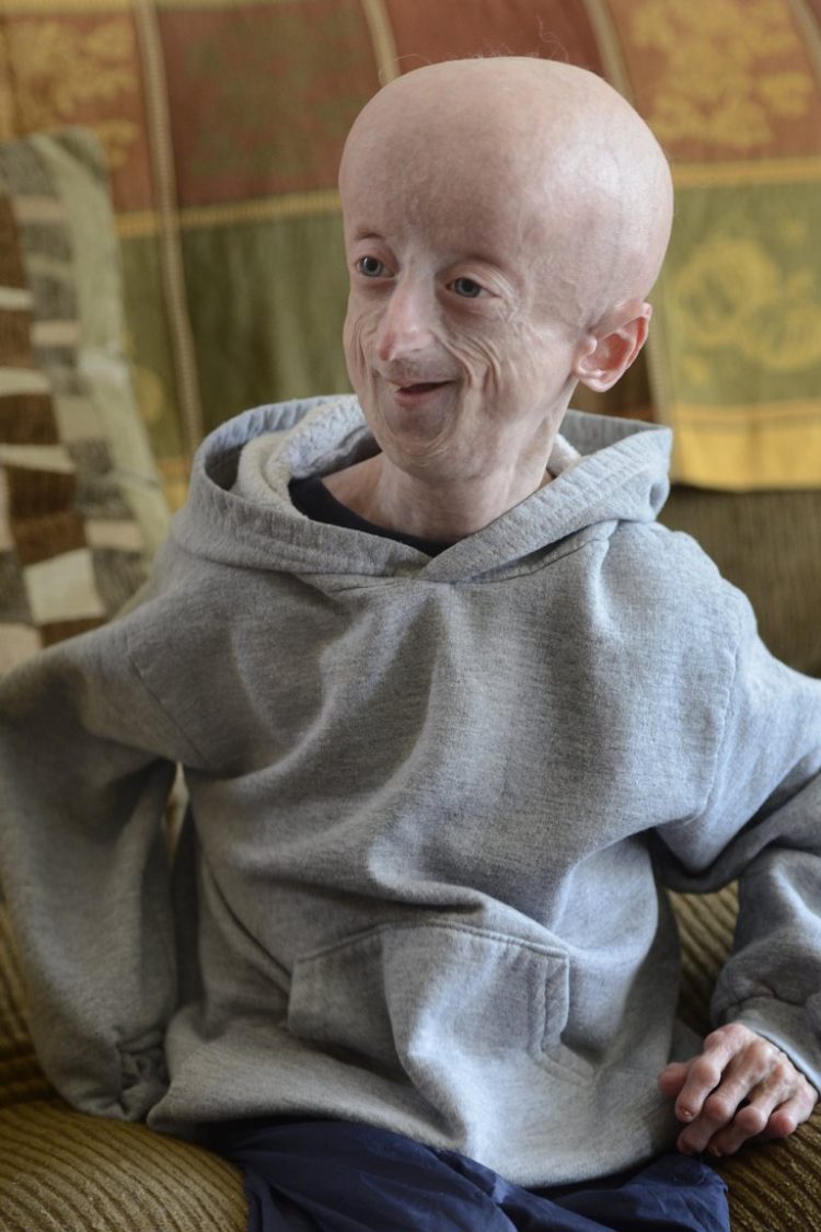 Envejecer en plena juventud Sammy Basso, biólogo y enfermo de progeria