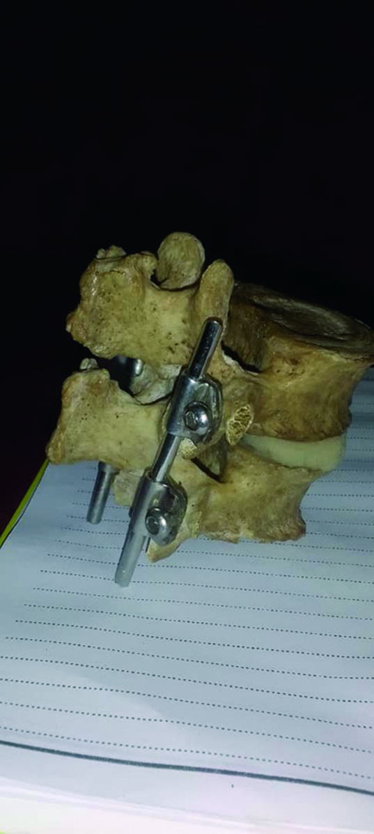 <strong>Creación divina en Pinar del Río</strong> En este sistema, la presilla fija la varilla y el tornillo a la presilla