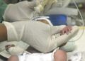 Nuevo aporte para el diagnóstico neonatal con tecnología SUMA Nuevo aporte para el diagnóstico neonatal con tecnología SUMA