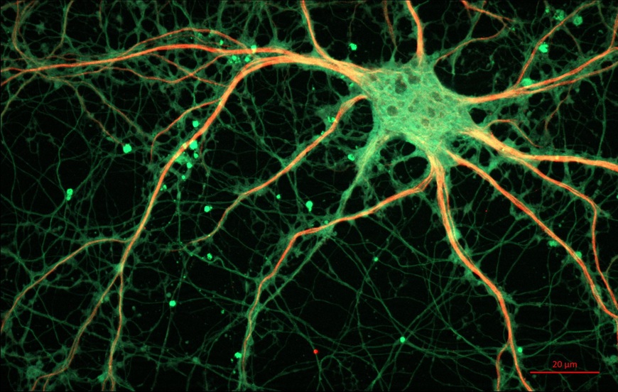 Optogenética: un camino iluminado para descifrar el cerebro